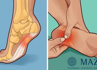 Consulta Maza ofrece Tratamiento de Fisioterapia en Bilbao para acabar con la Fascitis plantar.