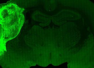 Logran implantar ‘minicerebros humanos’ en ratas para estudiar enfermedades neurológicas