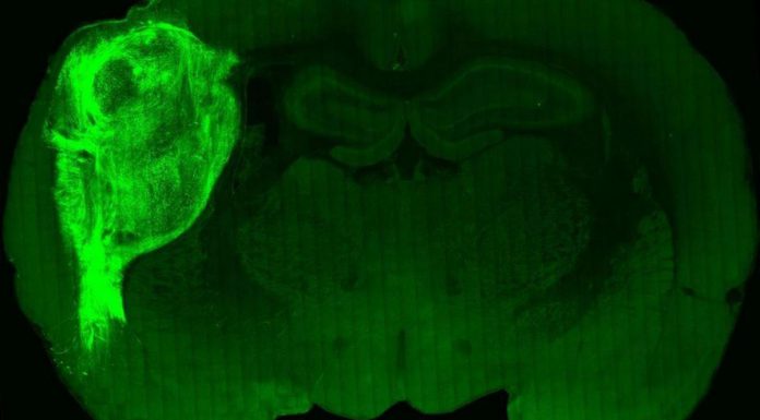 Logran implantar ‘minicerebros humanos’ en ratas para estudiar enfermedades neurológicas