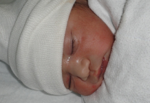 Ligero descenso de los nacimientos en Euskadi