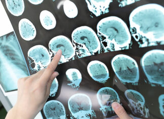 La solicitud online de imágenes de pruebas diagnósticas impulsa el uso de la Carpeta de Salud
